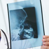 Radiografía del Cráneo en Barcelona  AMEDICS Centre Mèdic  al precio de 16€
