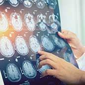 Resonancia Magnética Abierta Cerebral en Madrid  DMI Majadahonda  al precio de 115€